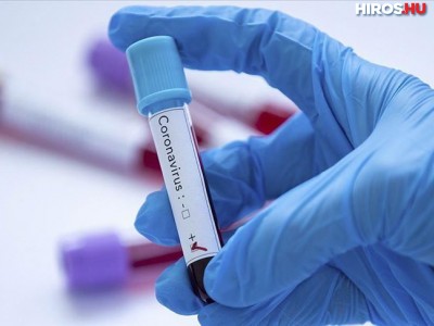 Teszt nélkül is hivatalosan koronavírusosnak minősíthet a háziorvos