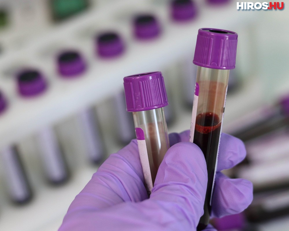 Beutaló nélküli vérvétel, laboratóriumi vizsgálat, vérvizsgálat 20%-os kedvezménnyel 